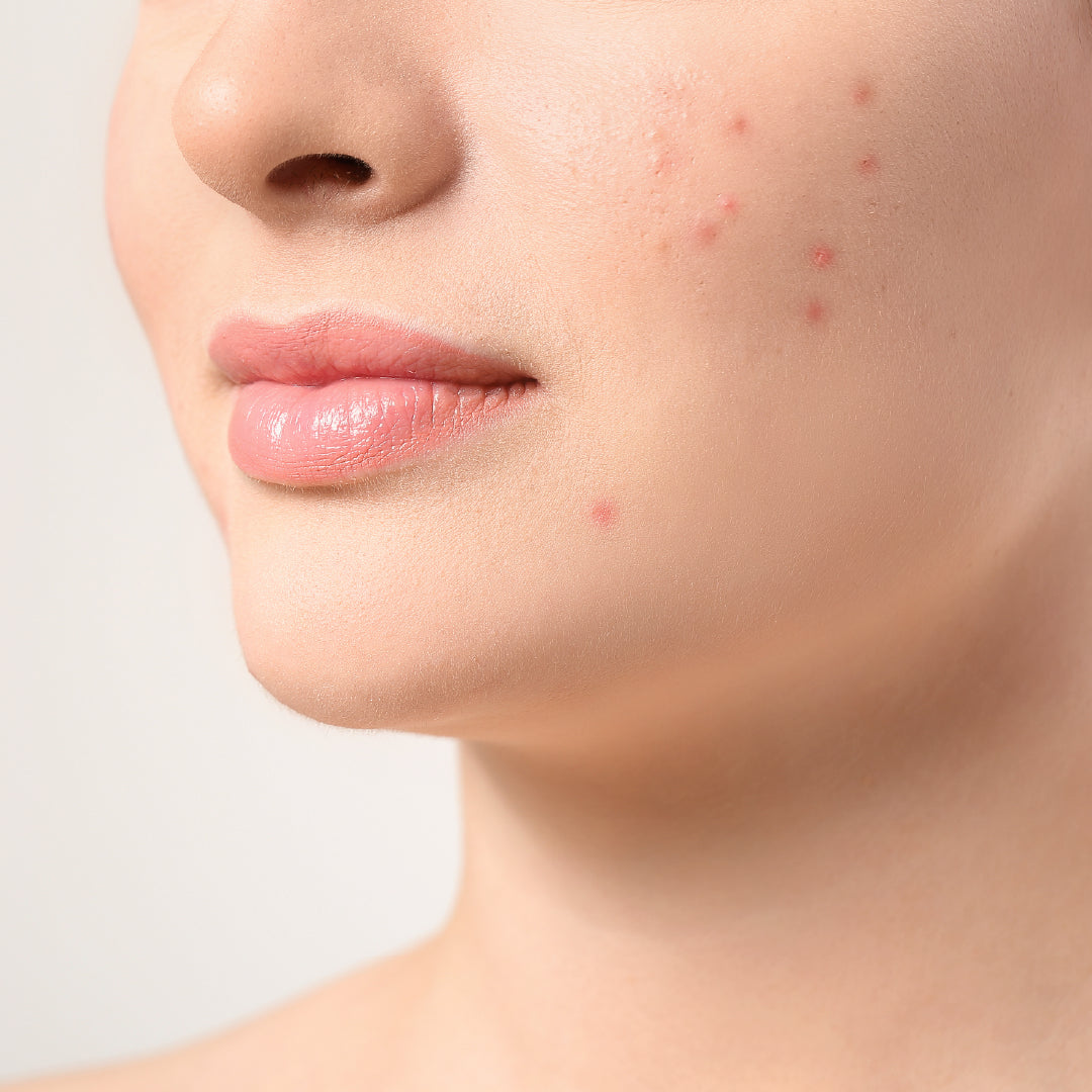 Inno-Derma® Deep Cleanser 200ml